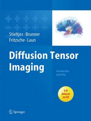 Diffusion Tensor Imaging: Introduction and Atlas de Bram Stieltjes