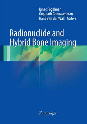 Radionuclide and Hybrid Bone Imaging de Ignac Fogelman