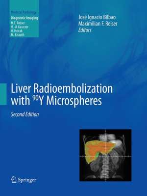 Liver Radioembolization with 90Y Microspheres de José Ignacio Bilbao