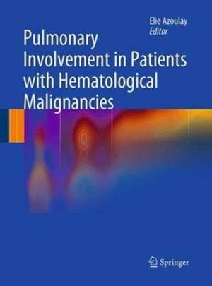 Pulmonary Involvement in Patients with Hematological Malignancies de Elie Azoulay