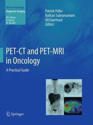 PET-CT and PET-MRI in Oncology: A Practical Guide de Patrick Peller