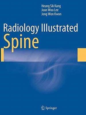 Radiology Illustrated: Spine de Heung Sik Kang