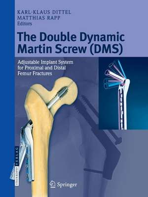 The Double Dynamic Martin Screw (DMS): Adjustable Implant System for Proximal and Distal Femur Fractures de Karl-Klaus Dittel