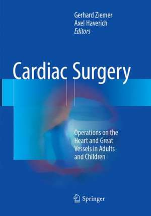 Cardiac Surgery: Operations on the Heart and Great Vessels in Adults and Children de Gerhard Ziemer