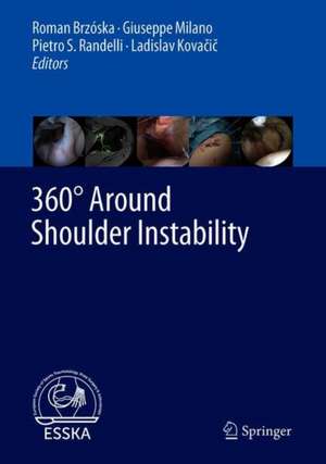 360° Around Shoulder Instability de Roman Brzóska