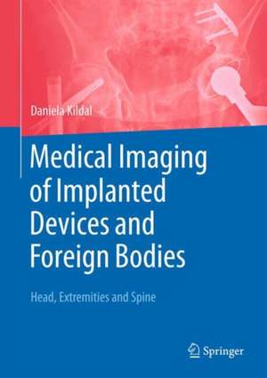 Medical Imaging of Implanted Devices and Foreign Bodies: Head, Extremities and Spine de Daniela Kildal