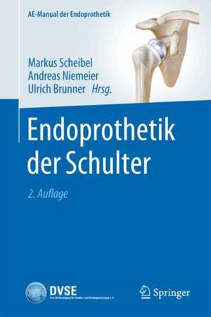 Endoprothetik der Schulter de Markus Scheibel