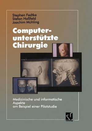 Computerunterstützte Chirurgie: Medizinische und informatische Aspekte am Beispiel einer Pilotstudie de Stephen Fedtke