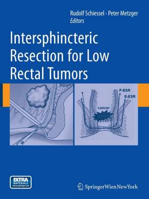 Intersphincteric Resection for Low Rectal Tumors de Rudolf Schiessel