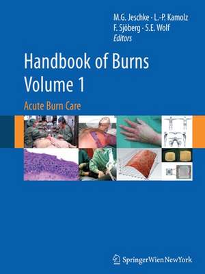 Handbook of Burns Volume 1: Acute Burn Care de Marc G. Jeschke