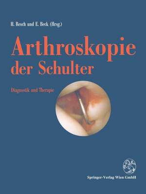 Arthroskopie der Schulter: Diagnostik und Therapie de Herbert Resch