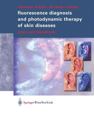 Fluorescence Diagnosis and Photodynamic Therapy of Skin Diseases: Atlas and Handbook de Clemens Fritsch