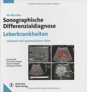 Sonographische Differentialdiagnose der Leber de Wolfram Wermke