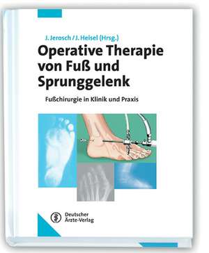 Operative Therapie von Fuß und Sprunggelenk de Jörg Jerosch