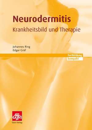 Neurodermitis - Krankheitsbild und Therapie de Johannes Ring