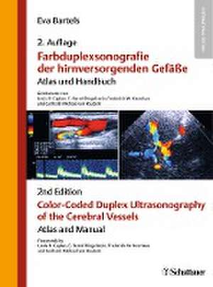 Farbduplexsonografie der hirnversorgenden Gefäße / Color-Coded Duplex Ultrasonography of the Cerebral Vessels de Eva Bartels