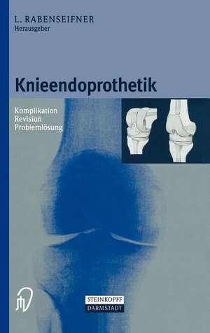 Knieendoprothetik: Komplikation - Revision - Problemlösung de Lothar Rabenseifner