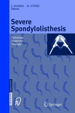 Severe Spondylolisthesis: Pathology - Diagnosis - Therapy de J. Harms