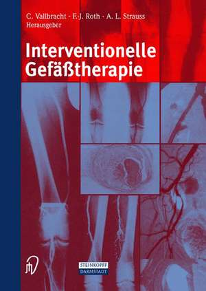 Interventionelle Gefäßtherapie de C. Vallbracht