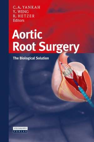 Aortic Root Surgery: The Biological Solution de Charles Abraham Yankah