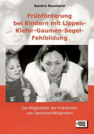 Frühförderung bei Kindern mit Lippen-Kiefer-Gaumen-Segel-Fehlbildung de Sandra Neumann