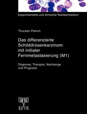 Das differenzierte Schilddrüsenkarzinom mit initialer Fernmetastasierung (M1) de Thorsten Petrich