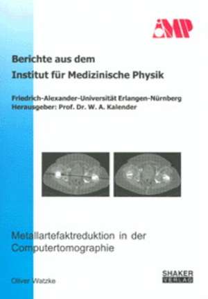 Metallartefaktreduktion in der Computertomographie de Oliver Watzke