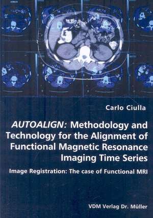 Autoalign: Methodology and Technology for the Alignment of Functional Magnetic Resonance Imaging Time Series: Image Registration: The Case of Functional MRI de Carlo Ciulla