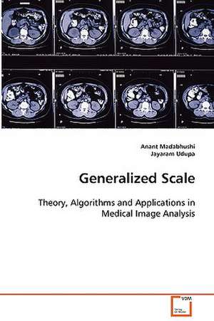 Generalized Scale de Anant Madabhushi