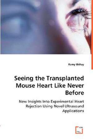 Seeing the Transplanted Mouse Heart Like Never Before de Ramy Bishay