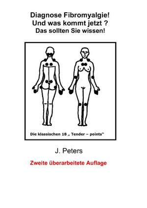 Diagnose Fibromyalgie! Und Was Kommt Jetzt?: Wo Ist Kurt? de Joachim Peters