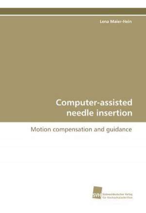 Computer-Assisted Needle Insertion: A Novel Histone Lysine Mono-Methyltransferase de Lena Maier-Hein