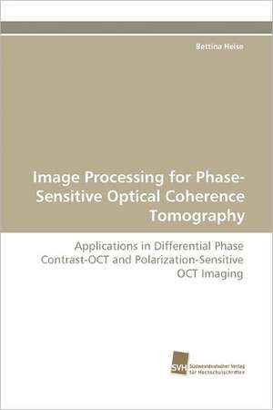 Image Processing for Phase-Sensitive Optical Coherence Tomography de Bettina Heise