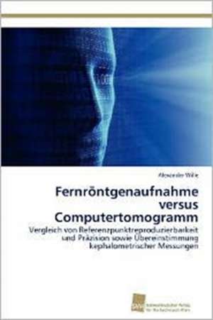 Fernrontgenaufnahme Versus Computertomogramm: Kontrolle Durch Kir-Genotyp Und HLA-Polymorphismus de Alexander Wille