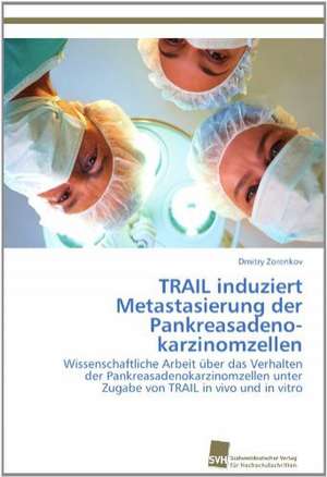 Trail Induziert Metastasierung Der Pankreasadenokarzinomzellen: Measurement and Source Allocation de Dmitry Zorenkov