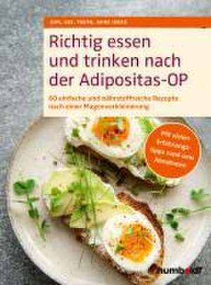 Richtig essen und trinken nach der Adipositas-OP de Dipl. Oec. Troph. Anne Iburg