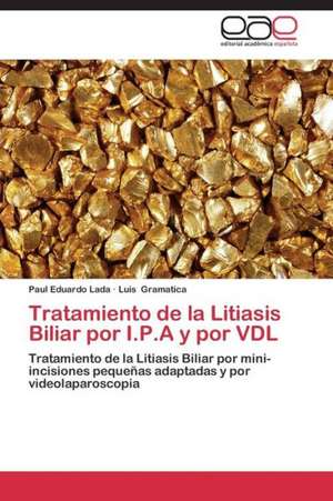 Tratamiento de la Litiasis Biliar por I.P.A y por VDL de Paul Eduardo Lada