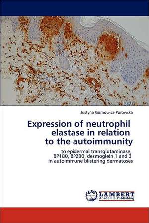 Expression of neutrophil elastase in relation to the autoimmunity de Justyna Gornowicz-Porowska