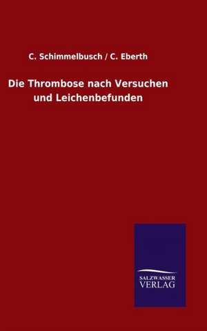 Die Thrombose Nach Versuchen Und Leichenbefunden: Die Bruder Vom Deutschen Hause / Marcus Konig de C. / Schimmelbusch C. Eberth