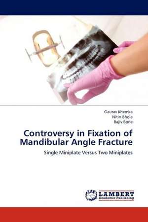 Controversy in Fixation of Mandibular Angle Fracture de Khemka Gaurav