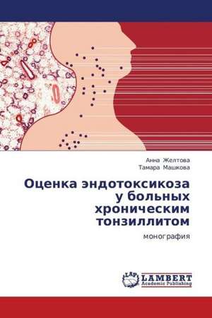 Otsenka endotoksikoza u bol'nykh khronicheskim tonzillitom de Zheltova Anna