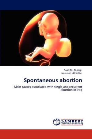 Spontaneous abortion de Saad M. Al-araji