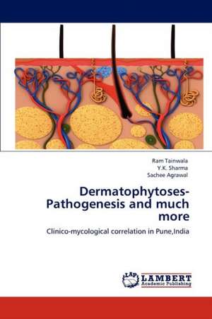 Dermatophytoses-Pathogenesis and much more de Ram Tainwala