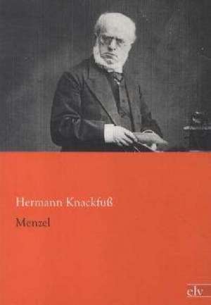 Menzel de Hermann Knackfuß