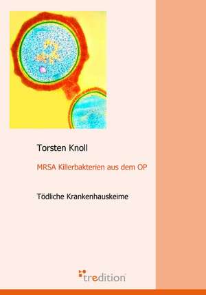 Mrsa Killerbakterien Aus Dem Op: Ku Czci Nowo Zalozonego Wydzialu Prawa I Administracji / In Honor of the New Faculty of Law and Administration / Zu Eh de Torsten Knoll