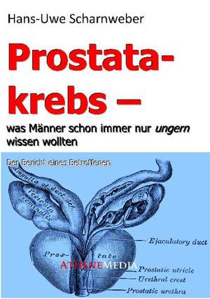 Prostatakrebs de Hans-Uwe Scharnweber