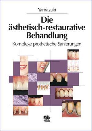 Ästhetisch-restaurative Behandlung de Masao Yamazaki