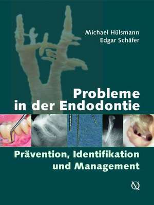 Probleme in der Endodontie: Prävention, Identifikation und Management de Michael Hülsmann