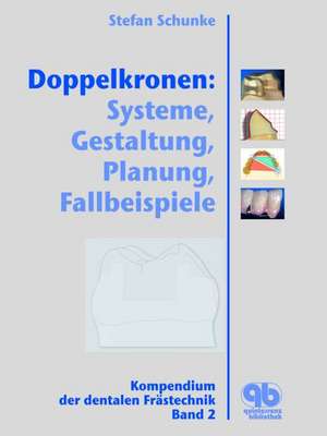 Doppelkronen: Systeme, Gestaltung, Planung, Fallbeispiele de Stephan Schunke