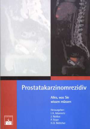 Prostatakarzinomrezidiv de I. A. Adamietz